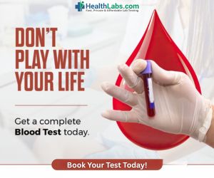 Ad Banner